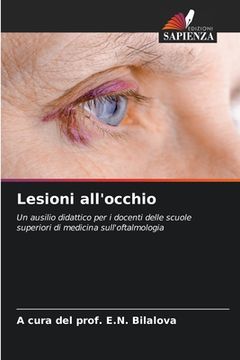portada Lesioni all'occhio (en Italiano)