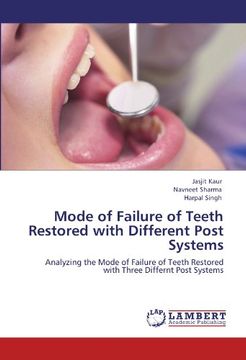 portada Mode of Failure of Teeth Restored with Different Post Systems: Analyzing the  Mode of Failure of Teeth Restored with Three Differnt Post Systems