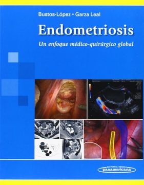 portada Endometriosis: Un enfoque medico-quirurgico global / A Comprehensive Medical and Surgical Approach