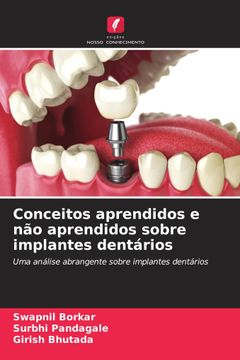 portada Conceitos Aprendidos e não Aprendidos Sobre Implantes Dentários