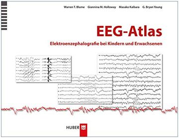 portada Eeg-Atlas (en Alemán)