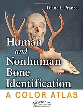 Human and Nonhuman Bone Identification: A Color Atlas