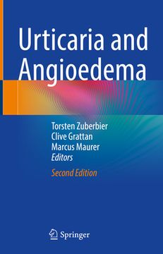 portada Urticaria and Angioedema (en Inglés)