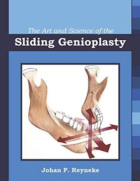 portada The art and Science of the Sliding Genioplasty (en Inglés)