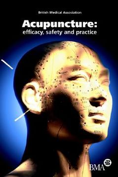 portada acupuncture: efficacy, safety and practice
