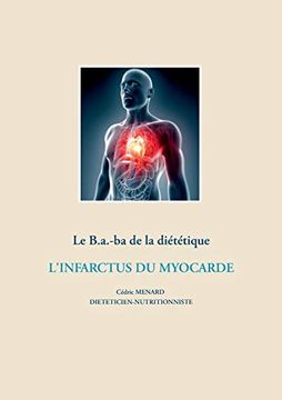 portada Le B. A. -Ba de la Diététique Après un Infarctus du Myocarde 