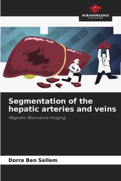 portada Segmentation of the hepatic arteries and veins (en Inglés)