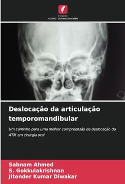 portada Deslocação da Articulação Temporomandibular: Um Caminho Para uma Melhor Compreensão da Deslocação da atm em Cirurgia Oral (en Portugués)