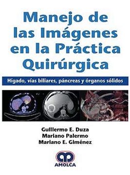 portada Manejo de las Imágenes en la Práctica Quirúrgica. Hígado, Vías Biliares, Páncreas y Órganos Sólidos (in Spanish)