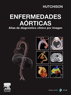 portada Enfermedades Aórticas: Atlas de Diagnóstico Clínico por Imagen (Con Dvd-Rom)