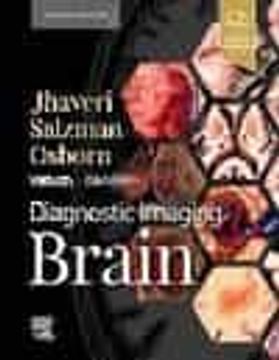 portada Diagnostic Imaging Brain