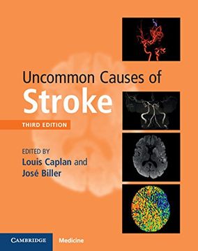 portada Uncommon Causes of Stroke (en Inglés)