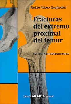 portada Fracturas del Extremo Proximal del Fémur. Estudio Anatomopatológico