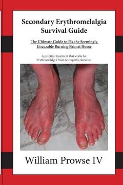 portada Secondary Erythromelalgia Survival Guide (en Inglés)