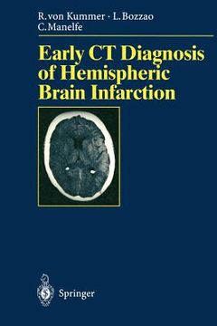 portada early ct diagnosis of hemispheric brain infarction