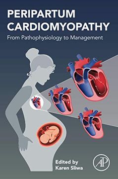 portada Peripartum Cardiomyopathy: From Pathophysiology to Management (en Inglés)