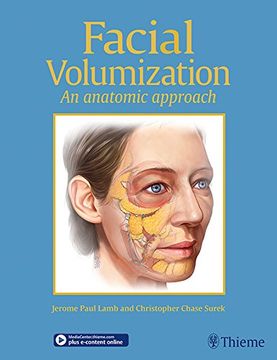 portada Facial Volumization: An Anatomic Approach (en Inglés)