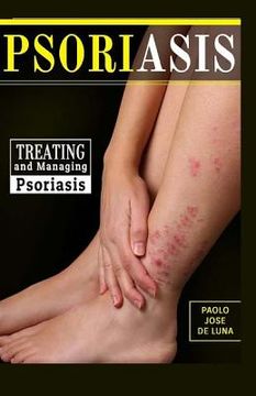 portada Psoriasis: Treating and Managing Psoriasis (in English)
