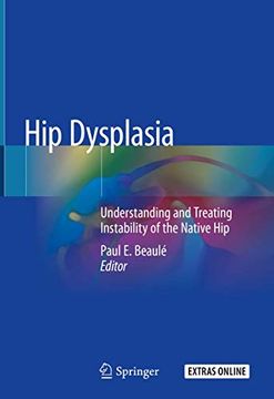 portada Hip Dysplasia: Understanding and Treating Instability of the Native hip (in English)