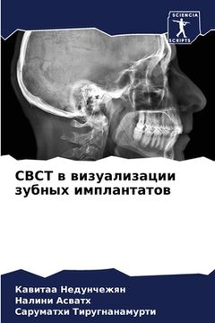 portada Cbct в визуализации зубных и&# (en Ruso)