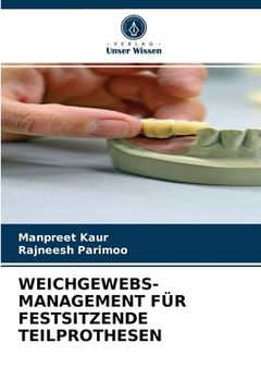 portada Weichgewebs- Management Für Festsitzende Teilprothesen (in German)