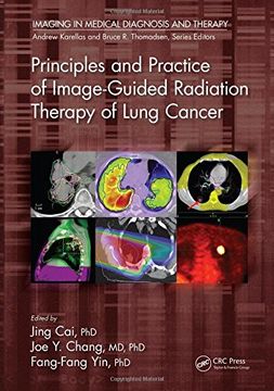 portada Principles and Practice of Image-Guided Radiation Therapy of Lung Cancer (in English)