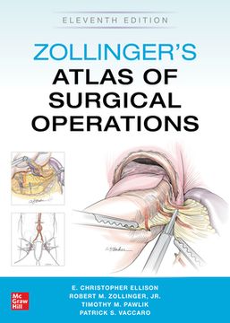 portada Zollinger'S Atlas of Surgical Operations (en Inglés)