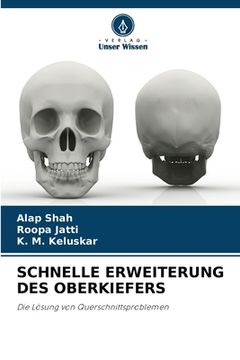 portada Schnelle Erweiterung Des Oberkiefers (en Alemán)