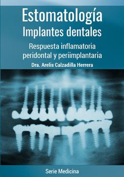 portada Estomatología. Implantes Dentales