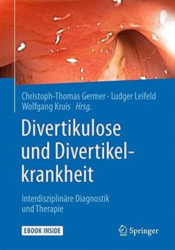 portada Divertikulose Und Divertikelkrankheit: Interdisziplinare Diagnostik Und Therapie