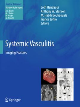 portada Systemic Vasculitis: Imaging Features (Medical Radiology) (en Inglés)