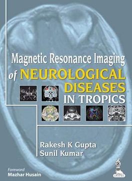 portada Magnetic Resonance Imaging of Neurological Diseases in Tropics (en Inglés)