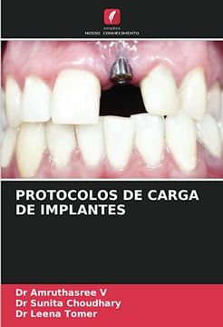 portada Protocolos de Carga de Implantes