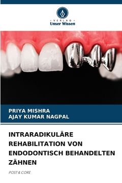 portada Intraradikuläre Rehabilitation Von Endodontisch Behandelten Zähnen (en Alemán)