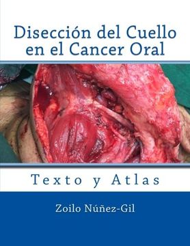 portada Diseccion del Cuello en el Cancer Oral (Spanish Edition)