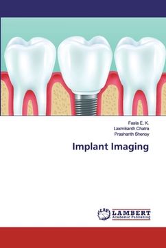 portada Implant Imaging