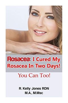 portada Rosacea: I Cured my Rosacea in two Days! You can Too! (in English)