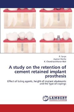portada A Study on the Retention of Cement Retained Implant Prosthesis