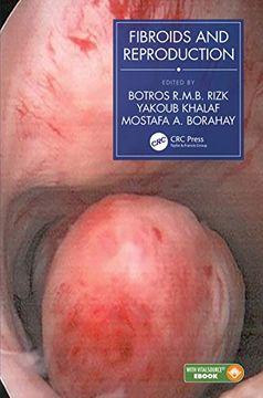 portada Fibroids and Reproduction (en Inglés)