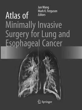 portada Atlas of Minimally Invasive Surgery for Lung and Esophageal Cancer (in English)