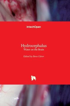 portada Hydrocephalus: Water on the Brain (en Inglés)