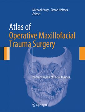 Atlas of Operative Maxillofacial Trauma Surgery: Primary Repair of Facial Injuries (en Inglés)