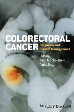 portada Colorectal Cancer: Diagnosis And Clinical Management