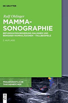 portada Mammasonographie: Befundkategorisierung Maligner und Benigner Mammaläsionen - Fallbeispiele (Frauenarztliche Taschenbucher) (in German)