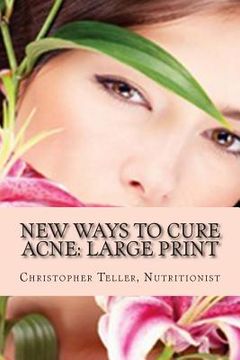 portada New Ways to Cure Acne: Large Print: Skin Care Acne Home Remedies and Treatment With A New Acne Diet (en Inglés)