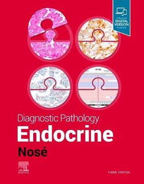 portada Diagnostic Pathology: Endocrine (en Inglés)