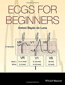 Ecgs for Beginners (en Inglés)