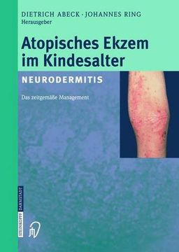 portada Atopisches Ekzem im Kindesalter (en Alemán)