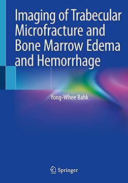 portada Imaging of Trabecular Microfracture and Bone Marrow Edema and Hemorrhage (in English)