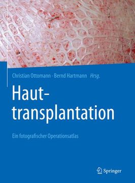 portada Hauttransplantation (en Alemán)